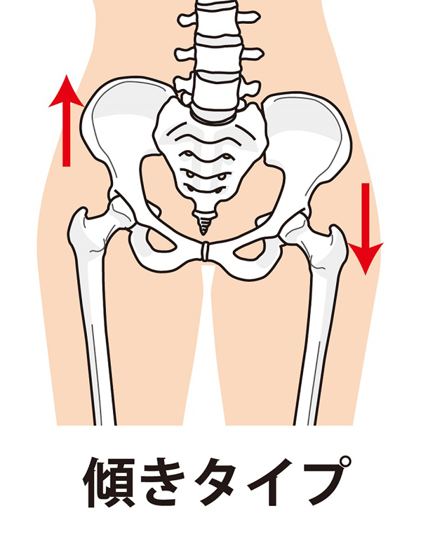 産後に様々な症状が出てしまう原因とは？