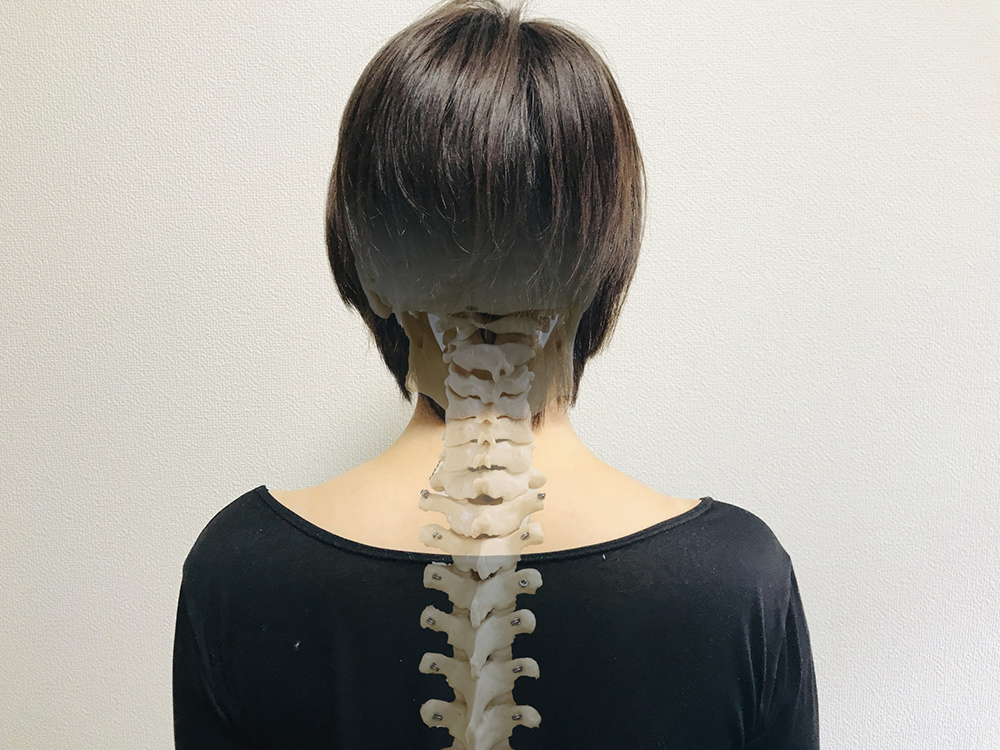 無痛矯正 整体整骨院 安芸郡海田市 矢野 府中町